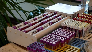 Akcja Krwiodawstwa "Zjednoczeni Krwią" Akcja Krwiodawstwa &quot;Zjednoczeni Krwią&quot;